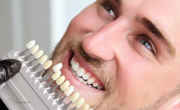 راه های سفیدی دندان؛ برای سفید شدن دندان چی خوبه؟